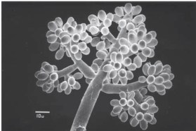 Jackson. Figure 9.1 - Grape-like cluster of Botrytis cinerea spores (conidia) produced on the spore-bearing structure, the conidiophore.