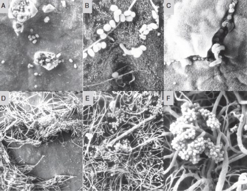 Magyar, Ildikó. “Botrytized Wines.” Advances in Food and Nutrition Research 63 (2011): 147-206. Figure 6.3 - (A) Botrytis conidia on the berry skin which has microinjuries in the cuticle; (B) conidia form germination tube on the epidermal layer of the berry skin; (C, D) the mycelia burst through the cuticle, and come to the surface; (E, F) heavy growth of mycelia and conidia formation on the surface.